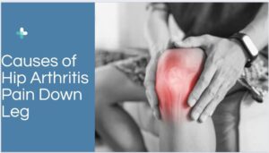 Causes of Hip Arthritis Pain Down Leg