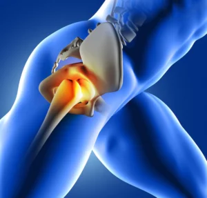How to Make Sense of SI Joint Pain