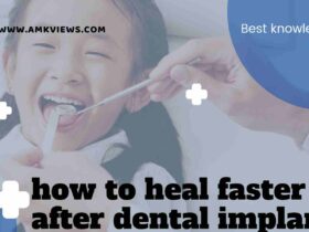 How to Healing Faster After Dental Implants