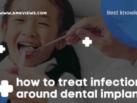 How to Treat Infection Around Dental Implants