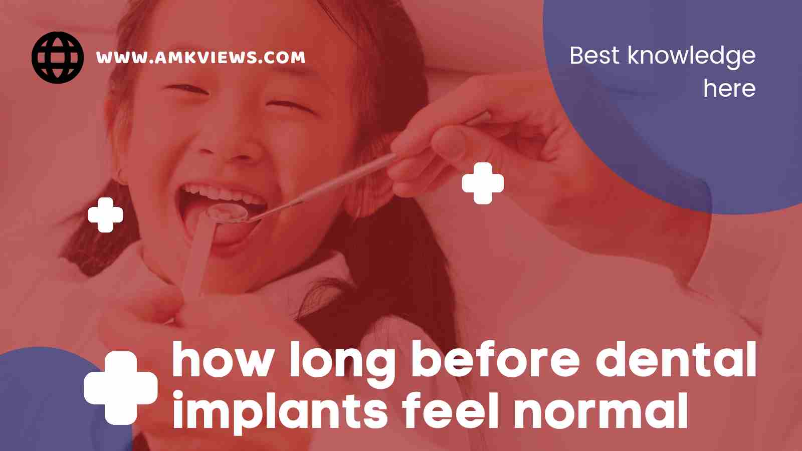 How Long Bеforе Dеntal Implants Fееl Normal