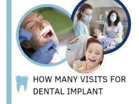 How many visits for dental implant are required