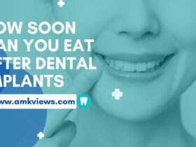 How soon can you eat after dental implants
