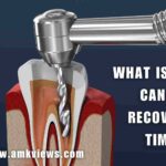 What is Root Canal Recovery Time
