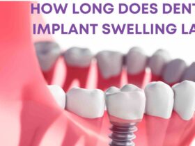 how long does dental implant swelling last