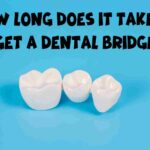 How long does it take to get a dental bridge