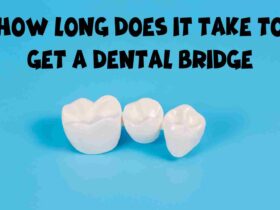How long does it take to get a dental bridge
