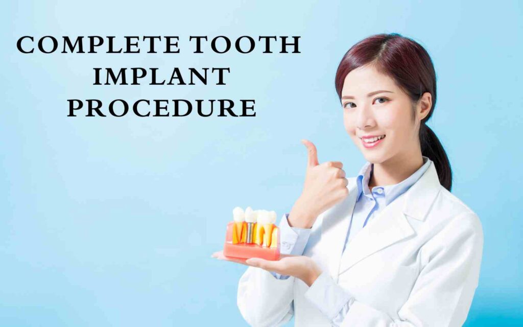 Tooth Implant Procedure