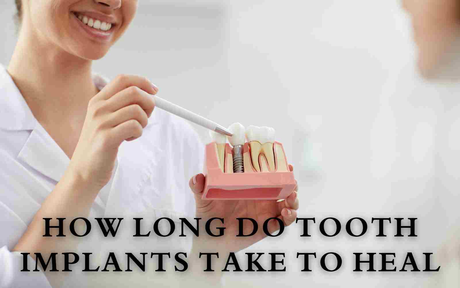 How Long Do Tooth Implants Take To Heal