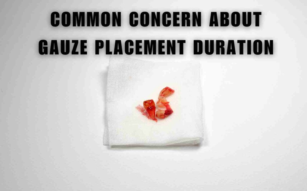 Common concern about gauze placement duration