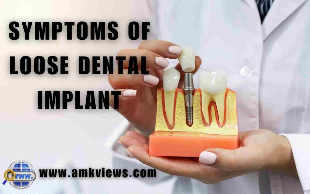 Symptoms of Loose Dental Implant