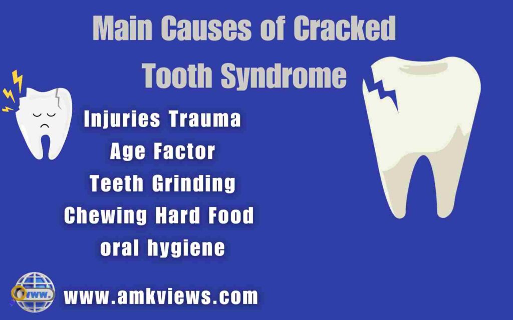 Main Causes of Cracked Tooth Syndrome