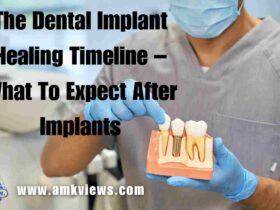 The Dental Implant Healing Timeline – What To Expect After Implants