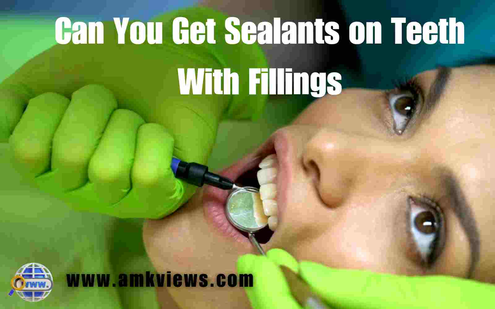 Can You Get Sealants on Teeth With Fillings