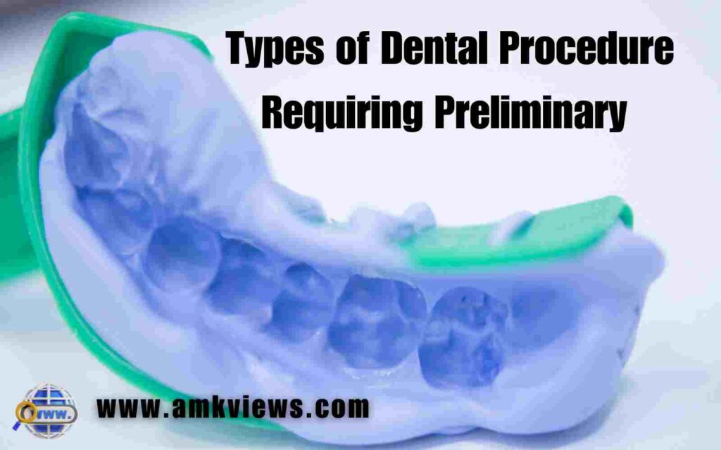 Types of Dental Procedure Requiring Preliminary Impressions