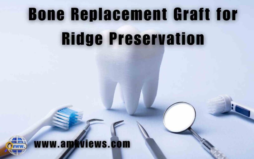 Bone Replacement Graft for Ridge Preservation