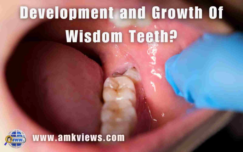 Why They Are Called Wisdom Tooth?