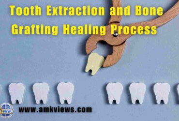 Tooth Extraction and Bone Grafting Healing Process