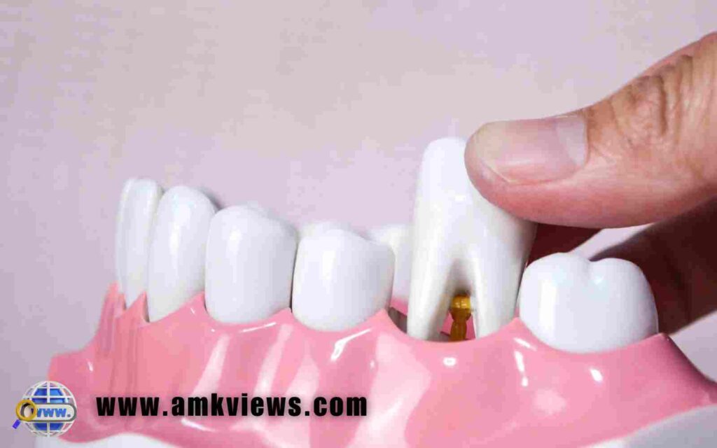 Tooth Extraction and Bone Grafting Healing Process