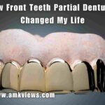 How Front Teeth Partial Dentures Changed My Life