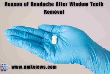 Reason of Headache After Wisdom Teeth Removal