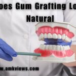 Does Gum Grafting Look Natural