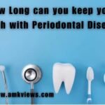 How Long can you keep your Teeth with Periodontal Disease