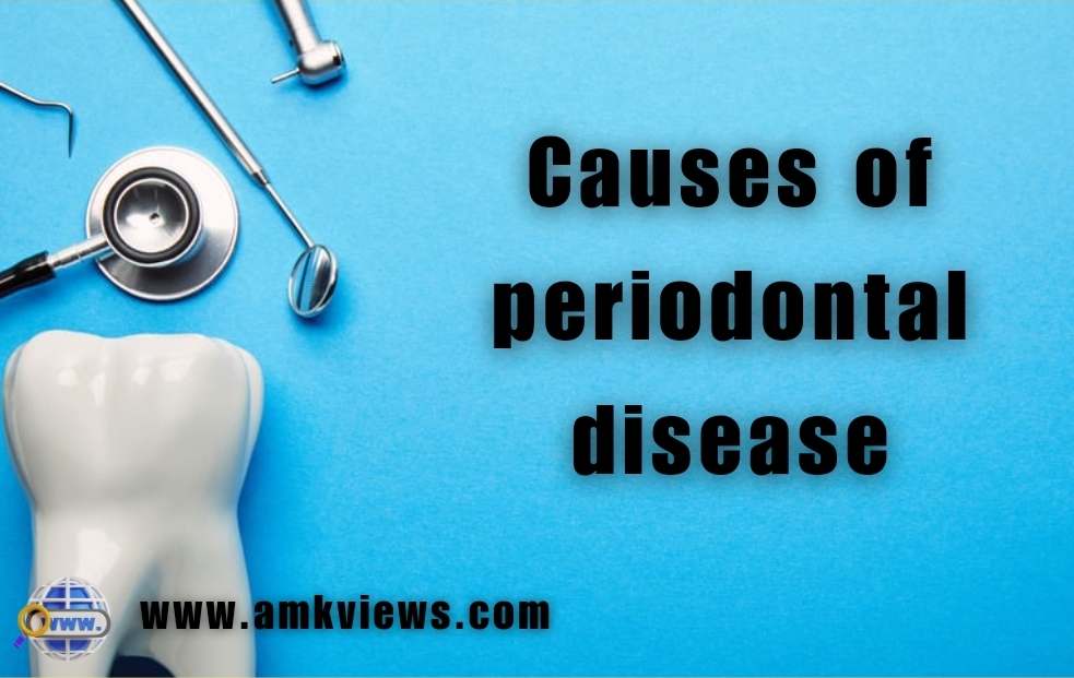 Causes of periodontal disease